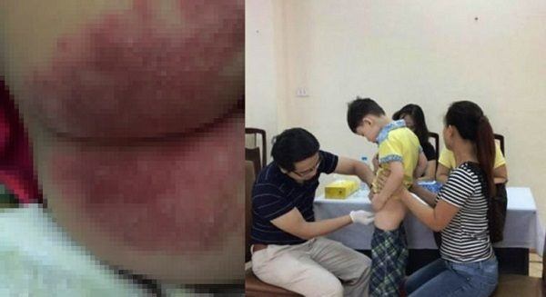 Hậu quả khi sử dụng bỉm giả Hậu quả khi sử dụng bỉm giả