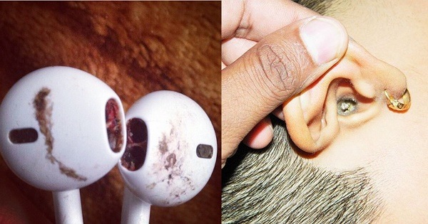 Hậu quả khôn lường khi sử dụng tai nghe giả